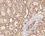 KVbeta1 (KCNAB1) Antibody in Immunohistochemistry (Paraffin) (IHC (P))