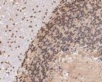 KVbeta1 (KCNAB1) Antibody in Immunohistochemistry (Paraffin) (IHC (P))