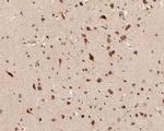 KVbeta1 (KCNAB1) Antibody in Immunohistochemistry (Paraffin) (IHC (P))