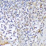 A1CF Polyclonal Antibody