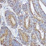 ABI1 Polyclonal Antibody