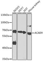 ACAD9 Polyclonal Antibody