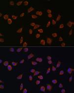 ACSS1 Polyclonal Antibody