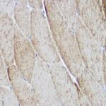 alpha Actinin 3 Polyclonal Antibody