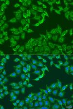 Centaurin alpha-1 Polyclonal Antibody