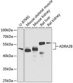 ADRA2B Polyclonal Antibody