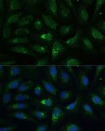 AEBP1 Polyclonal Antibody