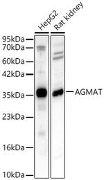 AGMAT Polyclonal Antibody