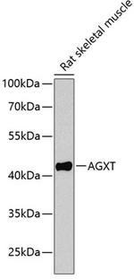 AGXT Polyclonal Antibody