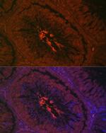 AKAP4 Antibody in Immunocytochemistry (ICC/IF)