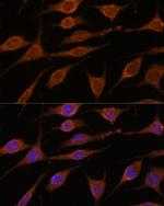 ALG5 Polyclonal Antibody