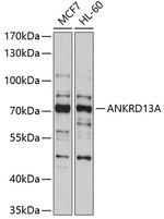 ANKRD13A Antibody in Western Blot (WB)