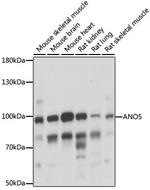 ANO5 Polyclonal Antibody