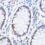 ANT1/ANT2/ANT3/ANT4 Polyclonal Antibody