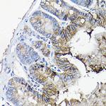 Annexin A13 Antibody in Immunohistochemistry (Paraffin) (IHC (P))