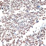 AQR Antibody in Immunohistochemistry (Paraffin) (IHC (P))