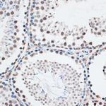 AQR Antibody in Immunohistochemistry (Paraffin) (IHC (P))