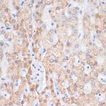 Amphiregulin Antibody in Immunohistochemistry (Paraffin) (IHC (P))