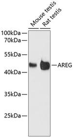 Amphiregulin Antibody in Western Blot (WB)