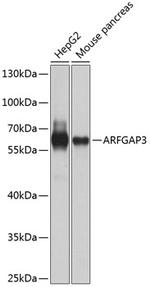 ARFGAP3 Antibody in Western Blot (WB)