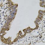 ARHGEF11 Antibody in Immunohistochemistry (Paraffin) (IHC (P))