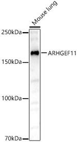 ARHGEF11 Antibody in Western Blot (WB)