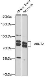 ARNT2 Polyclonal Antibody