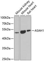 ASAH1 Polyclonal Antibody