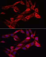 Asparagine Synthetase Polyclonal Antibody