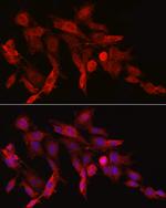 Asparagine Synthetase Antibody in Immunocytochemistry (ICC/IF)