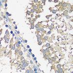 ASZ1 Antibody in Immunohistochemistry (Paraffin) (IHC (P))