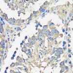 ASZ1 Antibody in Immunohistochemistry (Paraffin) (IHC (P))