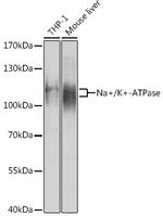 ATP1A1 Polyclonal Antibody