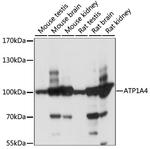 ATP1A4 Polyclonal Antibody