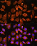 ATP5G2 Polyclonal Antibody