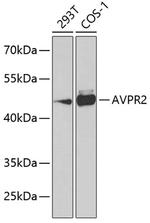 AVPR2 Polyclonal Antibody