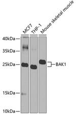 BAK1 Antibody in Western Blot (WB)