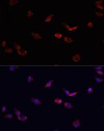 BMPR2 Antibody in Immunocytochemistry (ICC/IF)