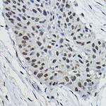 BRAP Antibody in Immunohistochemistry (Paraffin) (IHC (P))