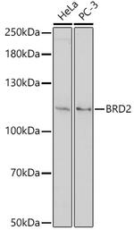 BRD2 Polyclonal Antibody