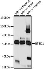 BTBD1 Polyclonal Antibody