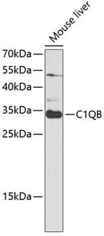 C1QB Polyclonal Antibody