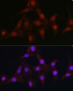 C9orf72 Antibody in Immunocytochemistry (ICC/IF)