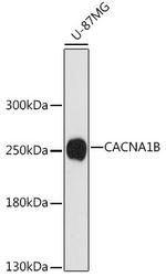 CACNA1B Polyclonal Antibody