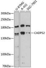 CADPS2 Polyclonal Antibody