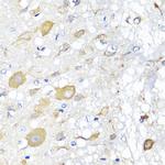 CALHM1 Polyclonal Antibody