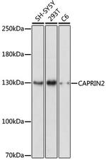 CAPRIN2 Polyclonal Antibody
