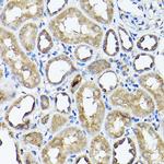 CC2D1A Antibody in Immunohistochemistry (Paraffin) (IHC (P))