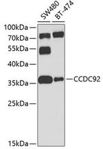 CCDC92 Polyclonal Antibody