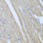 CCM2 Polyclonal Antibody